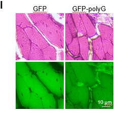 過表達(dá)poly-G蛋白導(dǎo)致小鼠肌肉出現(xiàn)邊緣液泡。對(duì)P1小鼠的肌肉注射AAV-GFP與AAV-GFP-poly-G病毒，三個(gè)月后對(duì)小鼠的肌肉進(jìn)行H&E染色，紅色為明場圖像，綠色為熒光拍攝圖像。圖像均由明美倒置熒光顯微鏡采集。