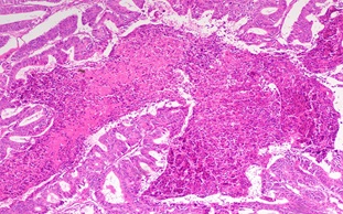 顯微鏡觀察方式之明場觀察