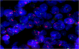 病毒“偵察兵”——揭秘疾控中心病毒實(shí)驗(yàn)室的顯微鏡應(yīng)用