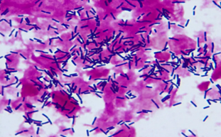 明美顯微鏡在疾控中心微生物檢測(cè)實(shí)驗(yàn)室的應(yīng)用