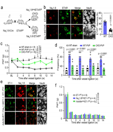 登錄國(guó)際期刊 | 南通大學(xué)團(tuán)隊(duì)使用明美倒置熒光顯微鏡MIX60-FL揭示血管痛新機(jī)制