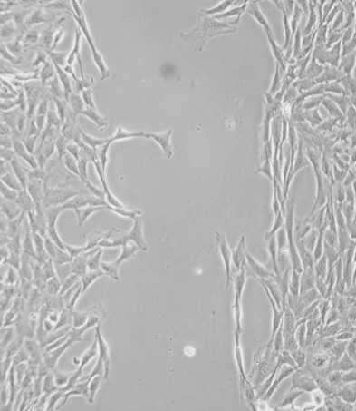 明美倒置熒光顯微鏡MF53-N助力中國(guó)藥科大學(xué)團(tuán)隊(duì)發(fā)現(xiàn)高血壓血管重構(gòu)重要靶點(diǎn)